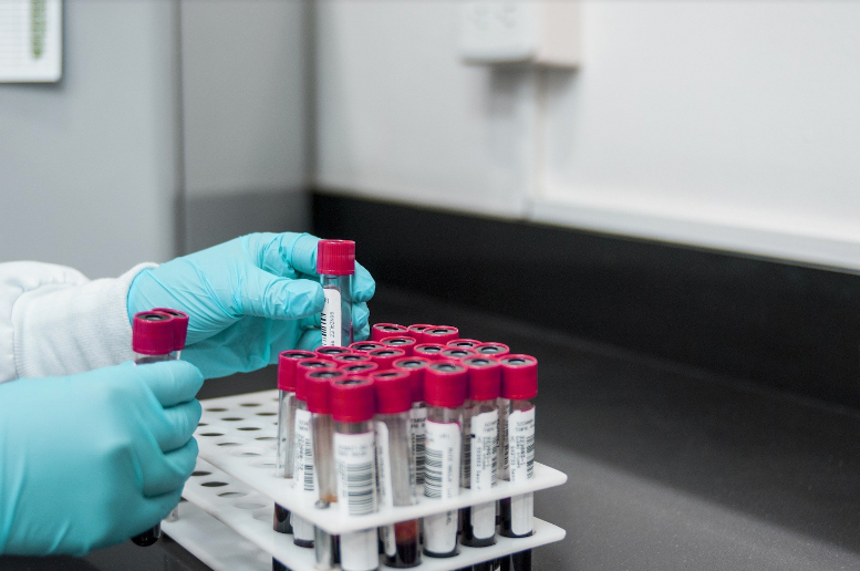 Testosterone blood samples | Gapin Institute